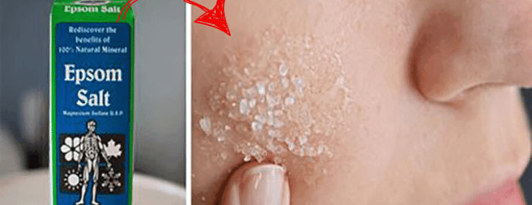 Therapist Reveals 10 Common Health Problems That Can Be Treated Using Epsom Salt