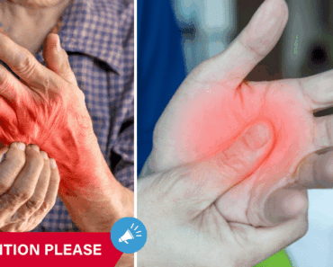 Do You Have Numbness or Tingling Sensations in Your Hands? THIS is What It Means
