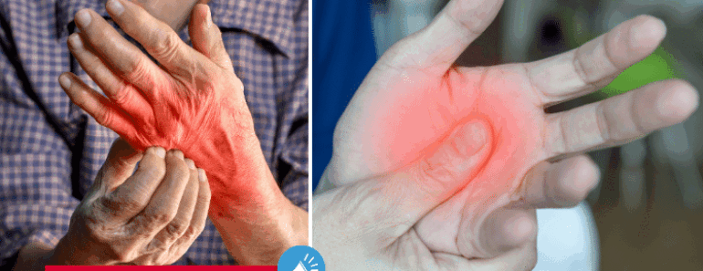 Do You Have Numbness or Tingling Sensations in Your Hands? THIS is What It Means