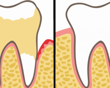 7 Everyday Habits That Are Wrecking Your Teeth—Dentists Reveal How to Fix Them Fast!
