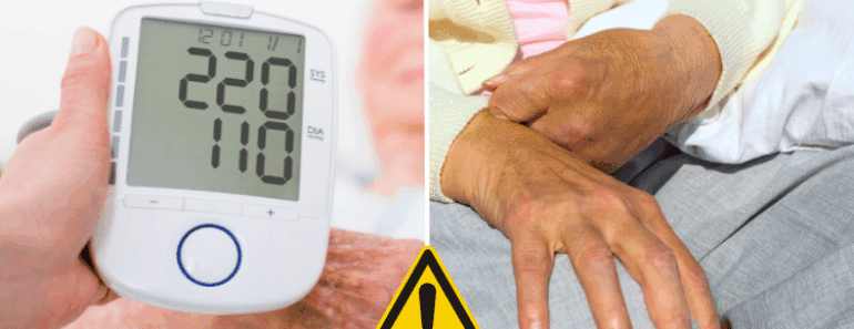 Stroke Is the #4 Killer — These New Guidelines Could Change That