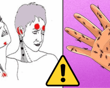 Warning: These Signs of Vitamin B12 Deficiency Should Never Be Ignored – Your Health Depends on It!