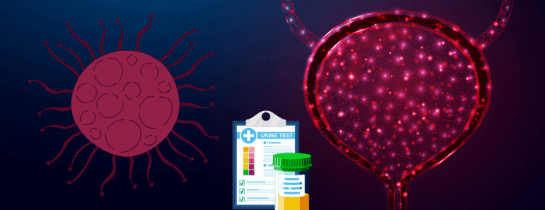 This ‘Silent’ Cancer Symptom Mimics a Common Infection – Don’t Ignore the Warning Signs!