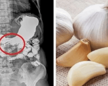 Here’s What Happens When You Eat Raw Garlic on an Empty Stomach Every Day — It’s Wild!