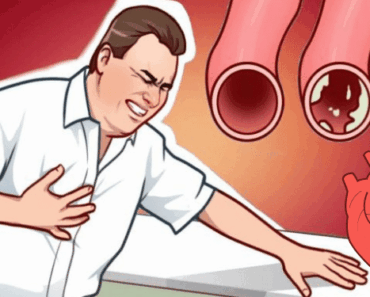 20 Artery-Cleansing Foods That Could Save Your Heart—#7 Will Surprise You!