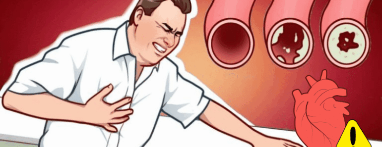 20 Artery-Cleansing Foods That Could Save Your Heart—#7 Will Surprise You!