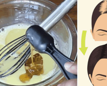 Mix These 3 Kitchen Ingredients and Watch Your Hair Grow Back Thicker and Stronger in Days!