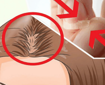 Eat THIS Every Day If You Have Brittle Nails, Thinning Hair, or Can’t Sleep Well