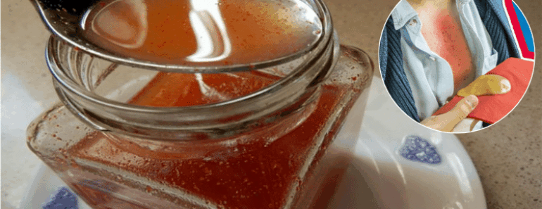 Clear Mucus and Crush That Cough Fast With This Powerful Home Remedy — Works Like Magic!