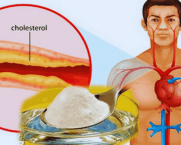 Top 5 Home Medicine Against Cholesterol and High Blood Pressure + Recipes