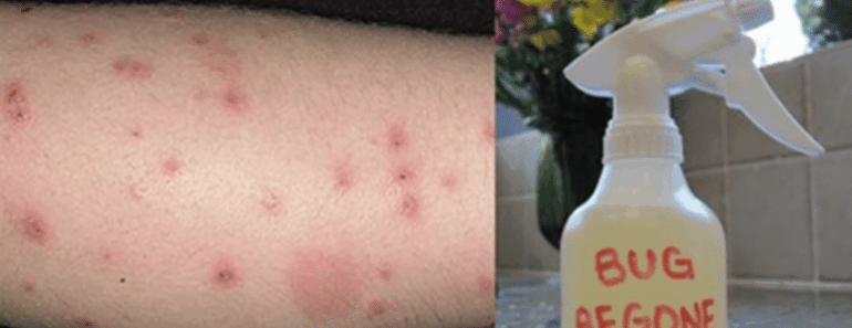 How to Make Homemade, Non-Toxic Mosquito Repellent That Works!