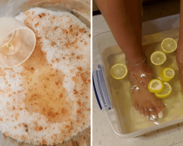Soak Your Feet in This Lemon Mix – What Happens Next Will Shock You!