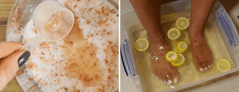 Soak Your Feet in This Lemon Mix – What Happens Next Will Shock You!