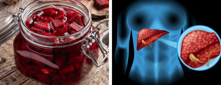 20 Foods That Cleanse the Liver and Flush Out Toxins Naturally
