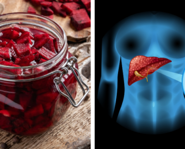 Shocking: 20 Everyday Foods Your Liver Craves to Eliminate Toxins Fast!